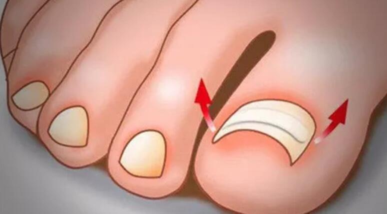 真实分享 美甲师的从业危害